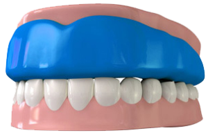 Mouth Guard