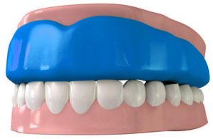 Both sports mouth guards and dental mouth guards are available in La Jolla and Pacific Beach San Diego.