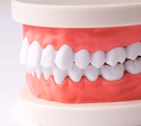 Implant supported as well as partial dentures are available to patients near La Jolla and Pacific Beach San Diego.